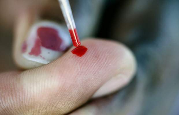 Saskatchewan licences blood test for colorectal cancer - image