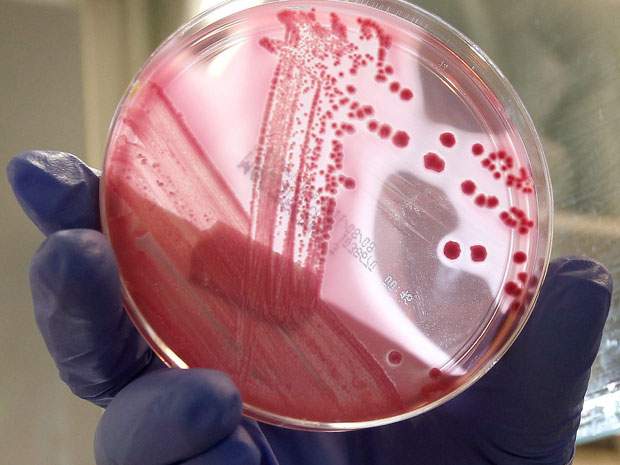 E. coli 101 - image