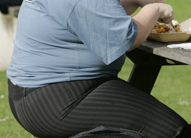 An overweight person eats in London, Eng., Wednesday, Oct. 17, 2007. A new report says getting physically active just 15 minutes a day would eliminate obesity in about one million Canadian adults. THE CANADIAN PRESS/AP-Kirsty Wigglesworth.