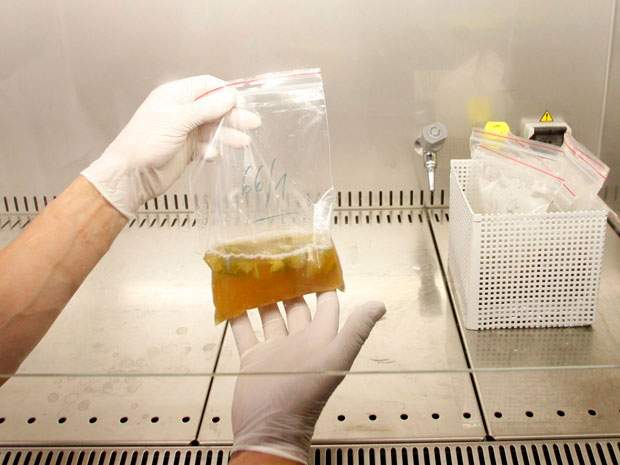 Deadly European E. coli strain previously unknown: WHO - image