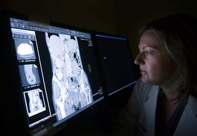 Dr. Rachel Kupets, surgical oncologist for Sunnybrook's Odette Cancer Centre Gynaecology Cancer Care team, looks at a CT scan in Toronto on Wednesday, June 1, 2011. 