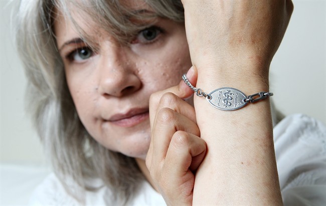 Carrie D'Arville shows off the MedicAlert bracelet she always wears due to her rare medical issues, at her home in London, Ontario, Saturday, July 16, 2010. MedicAlert is celebrating its 50th anniversary in Canada. THE CANADIAN PRESS/Dave Chidley.