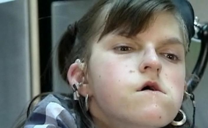 Mother fights for best care for handicapped teenage daughter - image