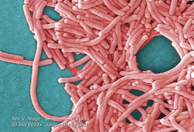 This 2009 colorized 8000X electron micrograph image provided by the Centers for Disease Control and Prevention shows a large grouping of Gram-negative Legionella pneumophila bacteria. Cases of Legionnaire’s disease have tripled in the last decade, U.S. health officials said Thursday, Aug. 18, 2011, but the risk of dying from it is lower because of more effective treatment. (AP Photo/Janice Haney Carr).
