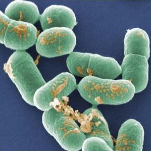 Listeria can progress to cause headaches, stiff neck, confusion, loss of balance and convulsions, and people with weakened immune systems are more vulnerable.