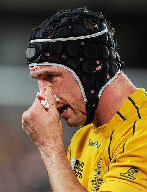 Australia's Dan Vickerman leaves field with bloody nose during their Rugby World Cup semifinal against New Zealand All Blacks at Eden Park, Auckland, New Zealand, Sunday Oct 16, 2011. (AP Photo/Ross Land).