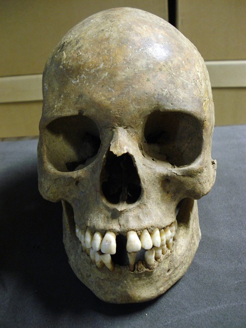 A skull from the East Smithfield plague pits in London, located under what is now the Royal Mint, is shown in this undated photo. A team of Canadian, German and American scientists has cracked the genetic code of the bacteria that is believed to have caused the Black Death. THE CANADIAN PRESS/HO, Museum of London via McMaster University.