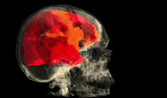 Researchers animate a female brain experiencing orgasm - image