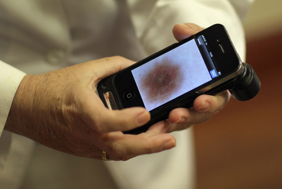 A doctor uses her iPhone while examining skin for symptoms of skin cancer due to sun exposure.