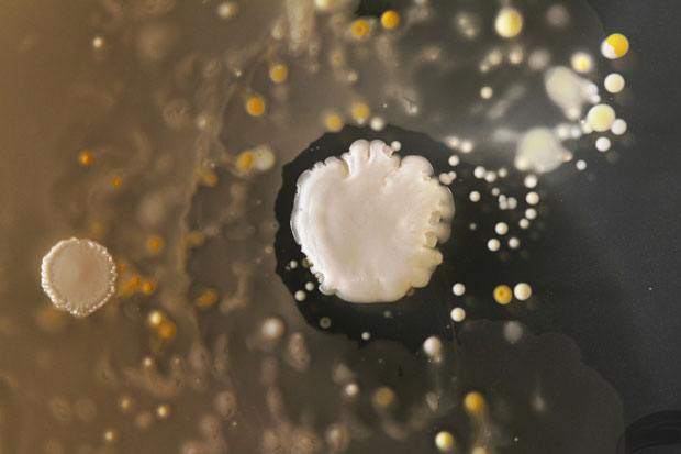 Cellphone bacteria