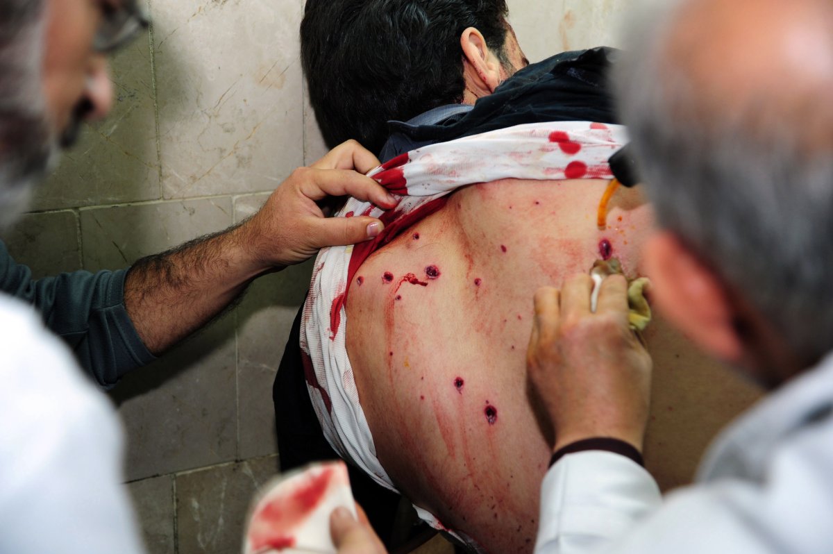 In this photo released by the Syrian official news agency SANA, Syrian doctors treat an injured man who was wounded at the open-air cafeteria at Damascus University in the central Baramkeh district, in Damascus, Syria, Thursday, March 28, 2013. Mortar shells slammed into a cafeteria at Damascus University, killing at several people and wounding scores, according to state media and an official. It was the deadliest in a string of such attacks on President Bashar Assad's seat of power, state media and an official said. (AP Photo/SANA).