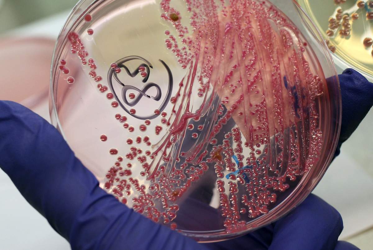 A lab technician holds a bacteria culture that shows a positive infection of enterohemorrhagic E. coli.