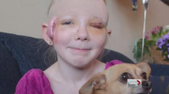 Jenna was attacked by a Pit Bull.