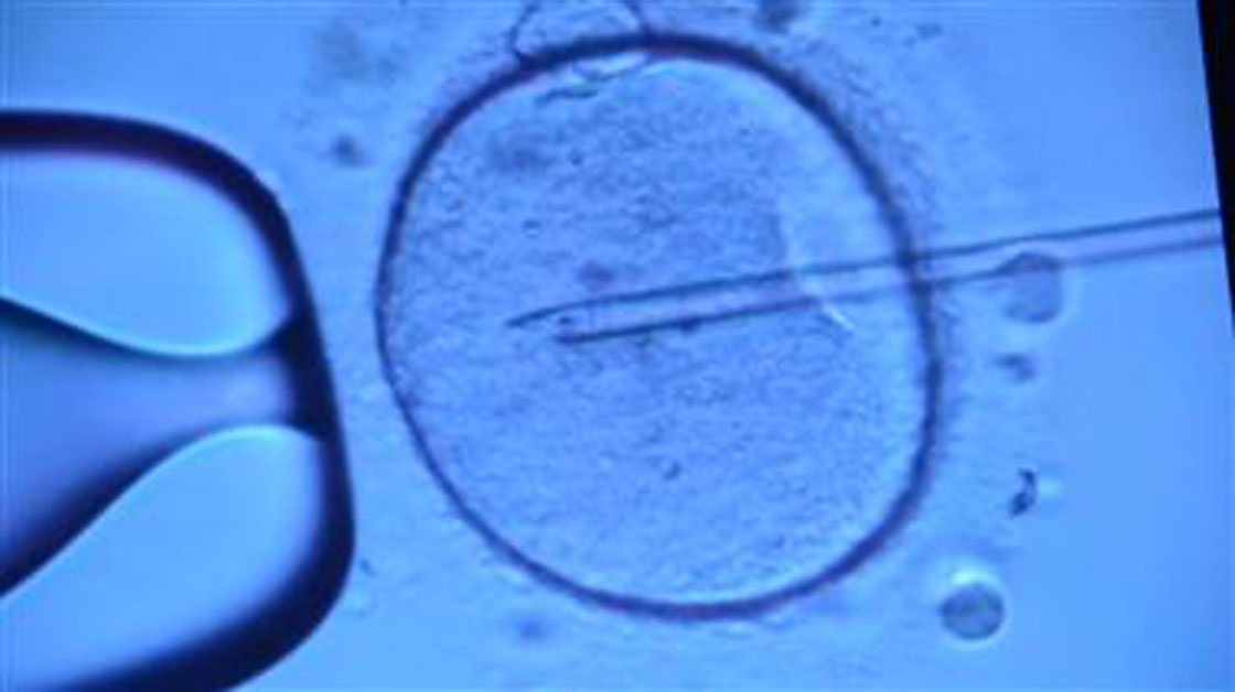 A human embryo is seen through a microscope.