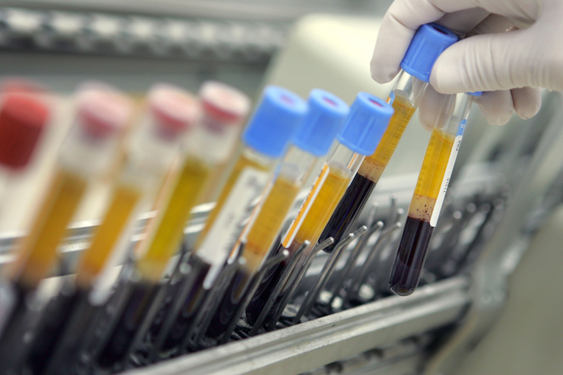 A laboratory technician places human blood samples on an automated testing line at the Maccabi Health Services HMO central testing laboratory January 22, 2006 in Nes Tsiona which is located in central Israel.