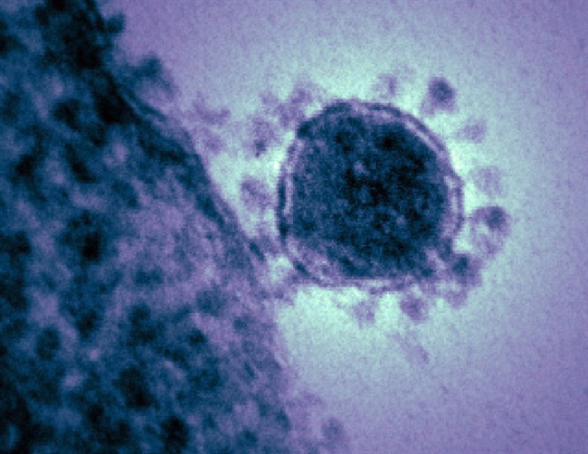 A coronavirus is shown in this colorized transmission electron micrograph.