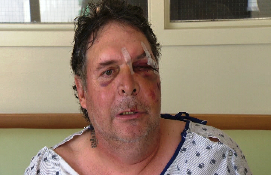 Tom Campen alleges he was beaten but Creston RCMP. 