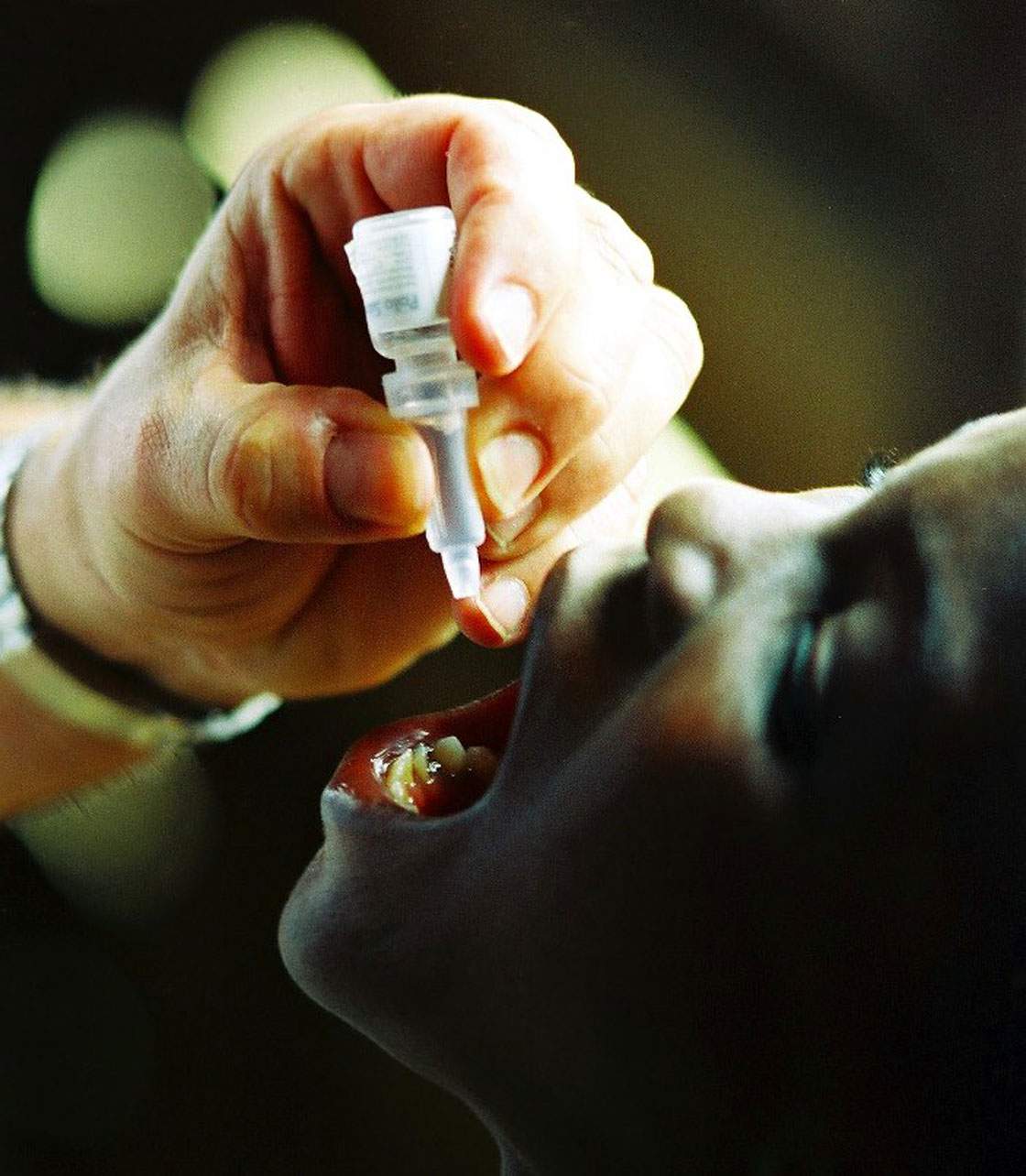 File -- A 6-year-old boy in Tiko, Cameroon, receives polio vaccine - and some helpful instruction - from Barry Howie, a member of the Rotary Club of Oakville Trafalgar, Ont., Canada. 