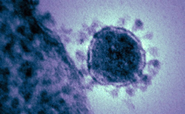 A coronavirus is shown in this colorized transmission electron micrograph. 