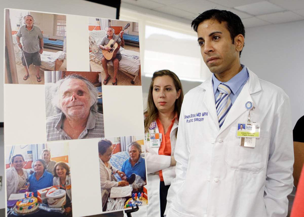 Dr. Urmen Desai, right and Dr. Wrood M. Kassira, both plastic surgeons, are shown during a news conference in Miami, Tuesday, May 21, 2013. The the photos on the left are of Ronald Poppo, a homeless man whose face was mostly chewed off in a bizarre attack last year in Miami. The attack left Poppo blind, but the doctors say he’s been working with an occupational therapist to learn how to take care of himself. The doctors say Poppo also has learned to play guitar and practices daily.