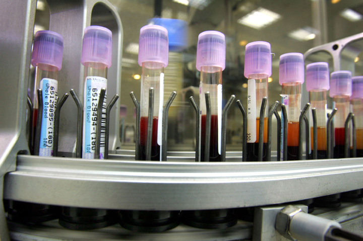 Would you take a blood test that could tell you how healthy you are in relation to age and how long you’ll live?.