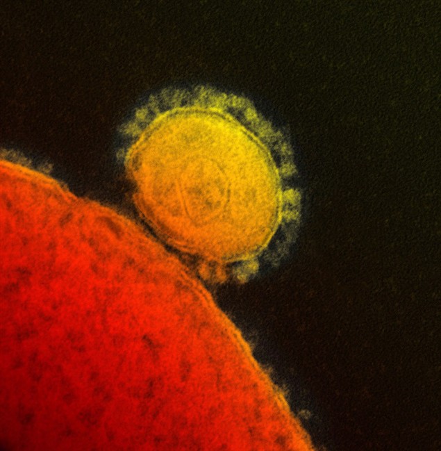 A colorized transmission electron micrograph showing a virion of the novel coronavirus that emerged in 2012 is shown in a handout photo.Authorities in Saudi Arabia say they have found two more people who were infected with the new coronavirus in a large cluster of cases in the eastern portion of the country. 