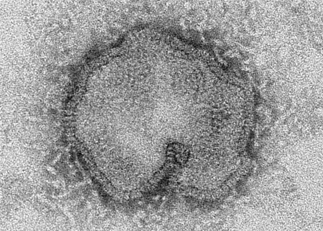 This April 15, 2013 electron microscope image shows the H7N9 virus. 