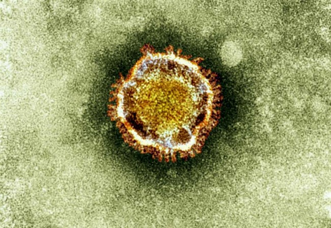 A Canadian infectious diseases expert who is helping to investigate a large coronavirus outbreak in Saudi Arabia says she understands people's frustration about the lack of information on the situation.