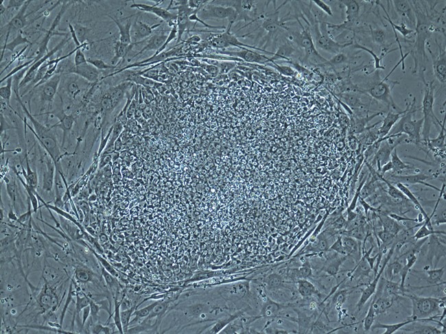 This undated image made available by the Oregon Health & Science University in May 2013 shows a stem cell colony developed from cloned human embryos. Scientists have finally recovered stem cells from cloned human embryos, a longstanding goal that could lead to new treatments for such illnesses as Parkinson's disease and diabetes.