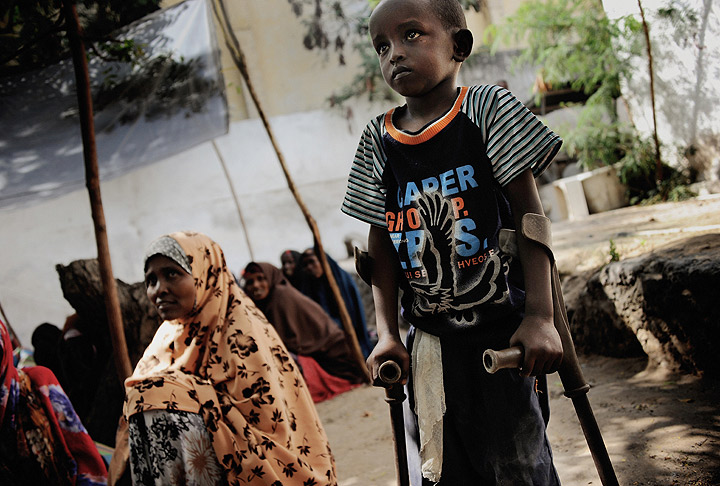Liban Ibrahim, 8, awaits a food distribution, at a UNICEF supported feeding centre for people with disabilities, in Mogadishu, the capital. He lost his leg five months before when a bomb exploded in the city centre. Children with disabilities are among some of the most marginalized people in the world, according to a new report from UNICEF. 