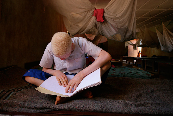 In Tanzania, a boy who is blind and has albinism reads Braille at a UNICEF supported primary school for children with disabilities in the town of Moshi, Kilimanjaro Region (Photo credit: Giacomo Pirozzi/UNICEF)