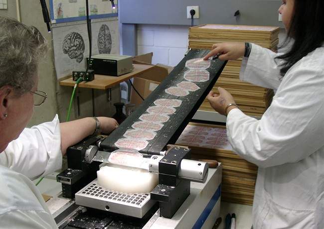 The brain was sliced into 7,000 pieces
