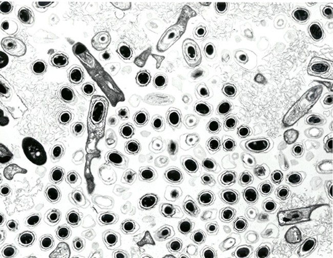 Bacillus anthracis spores are pictured in this undated photomicrograph from the official U.S. Department of Defense anthrax information website.