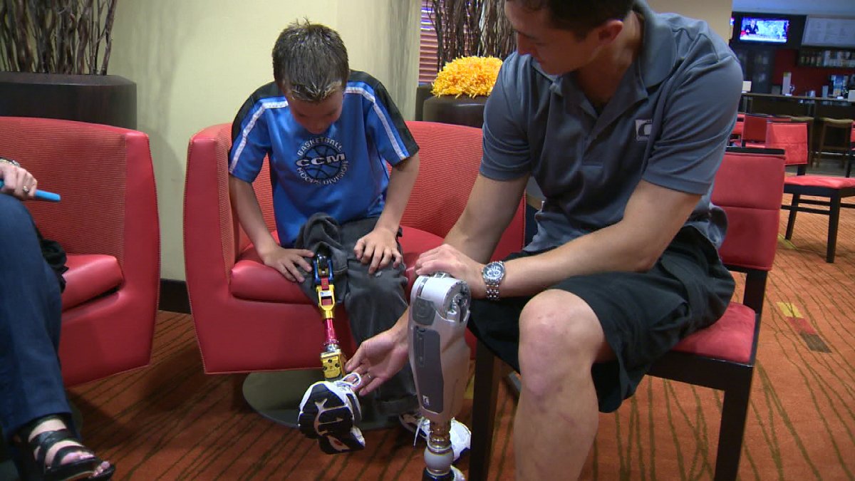 Jacob LeBlanc show off his prosthetic to Jay Fain, a US army veteran who lost his leg in Iraq,.