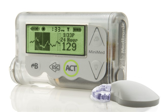 This October 2012 image provided by Medtronic shows the MiniMed Integrated System device, which doctors are reporting as a major step toward an "artificial pancreas.".