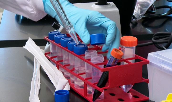 Saskatoon’s Prairie Diagnostic Services Inc. to provide anthrax testing in Saskatchewan.