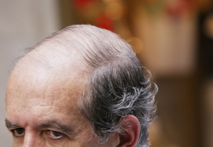A balding man stands in Midtown Manhattan June 26, 2003 in New York City.