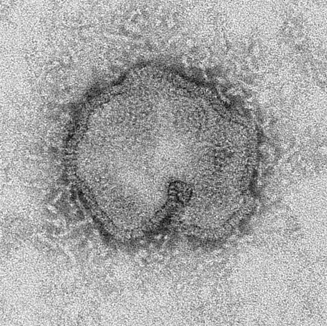 This April 15, 2013 electron microscope image provided by the Centers for Disease Control and Prevention shows the H7N9 virus which can take on a variety of shapes. 