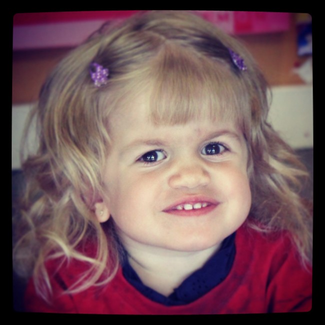 Three-year-old Aleena Sadownyk has Maroteaux–Lamy Syndrome (MPS), which sees cellular waste build up in her joints and around her heart. A drug called Naglazyme can arrest the build up.  THE CANADIAN PRESS/HO.