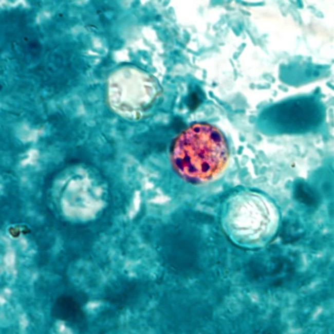 In this image provided by the Centers for Disease Control and Prevention, a photomicrograph of a fresh stool sample, which had been prepared using a 10% formalin solution, and stained with modified acid-fast stain, reveals the presence of four Cyclospora cayetanensis oocysts in the field of view. 
