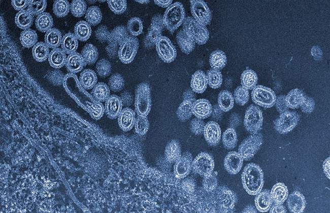 Bird flu kills 9-year-old boy in Cambodia, country’s 10th fatal victim this year - image