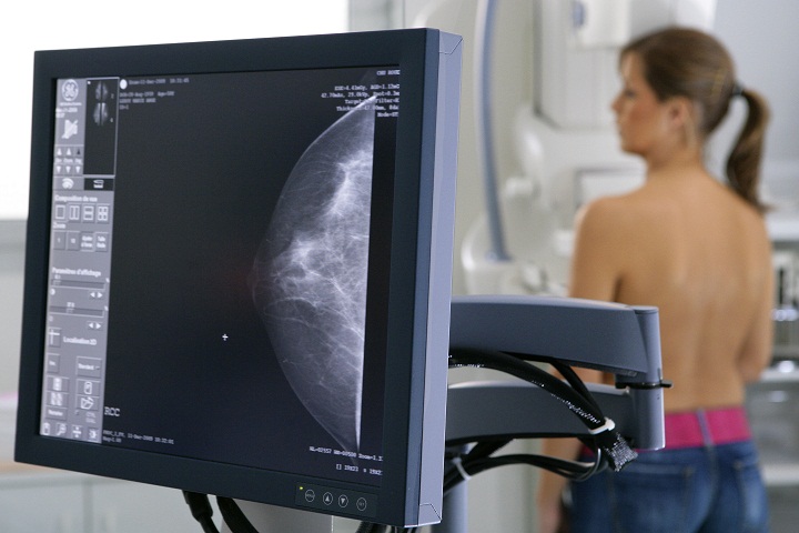FILE -- Mammography.