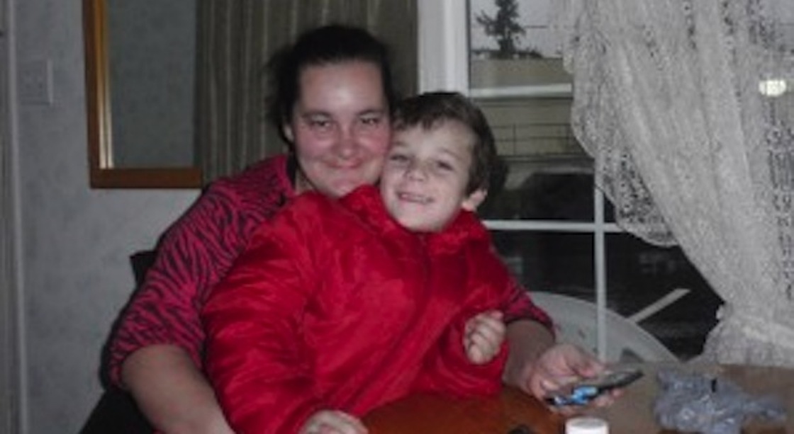Tragic turn for child with severe burns - image