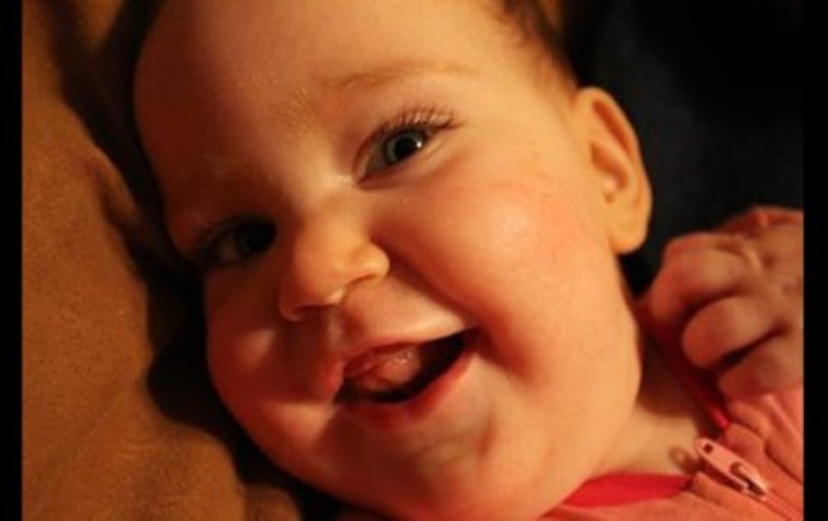 Armstrong girl with rare genetic disorder needs help - image