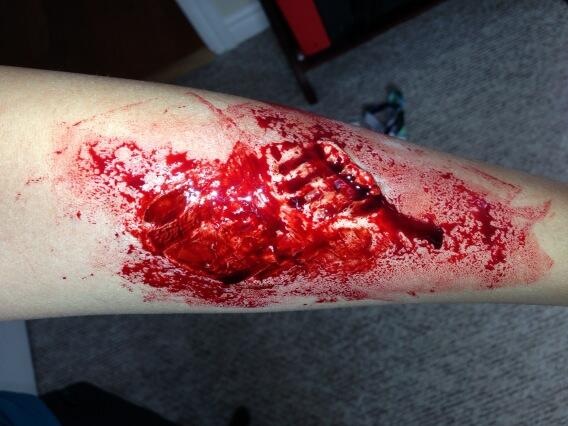 Zombie bite makeup by Marc Deveault. (Photo: Cory McGraw)