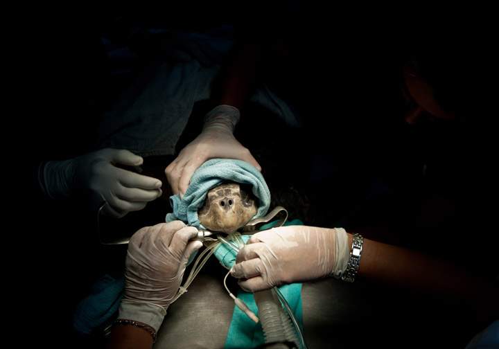 Veterinarians operate on a Galapagos green turtle (Chelonia mydas agassisi) to extract a fishhook from its esophagus in San Salvador, El Salvador on October 18, 2013. Surgery to take the fishhook out will be done by Dr. Abel Ciudad Real, a volunteer of the Zoological Foundation of El Salvador, who also operated another Galapagos green turtle with a head injure. Both turtles were rescued by volunteers at La Costa del Sol beach, 70 km. south of San Salvador after spawning. The Galapagos green turtle in an endangered species. (Photo credit: Getty Images)