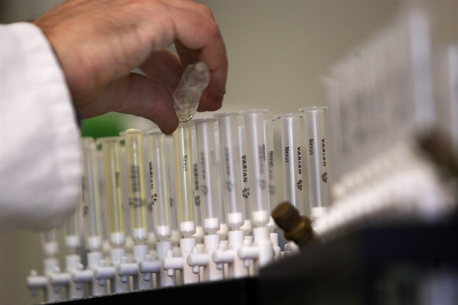  In this Feb. 5, 2010 file photo, a laboratory technician prepares samples of urine for doping tests during a media open day, at the King's College London Drug Control Centre, London. 