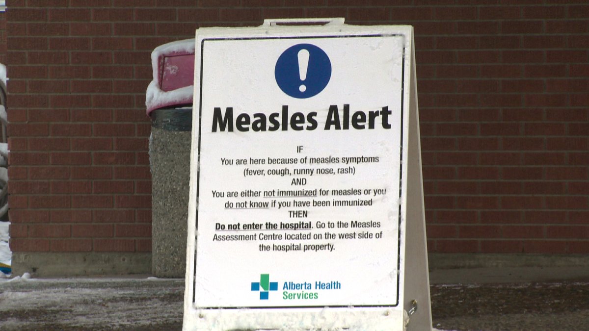 Alberta Health Services (AHS) officially declared a measles outbreak in Calgary, Edmonton and central Alberta on Wednesday, April 30th, 2014.