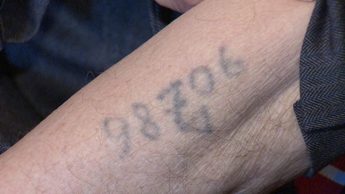Philip Riteman shows the serial number that was tattooed into his left arm.