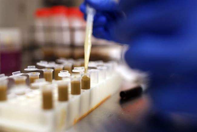 U of A researchers see promise in new enzyme treatment for MS.
